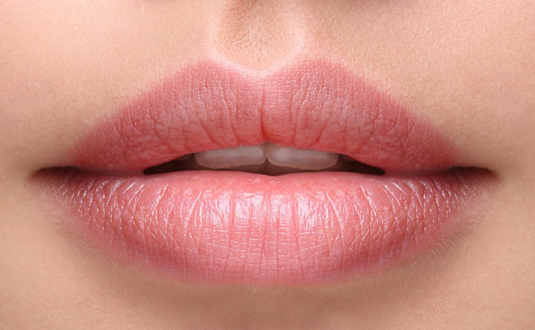 Volume treatment with Hyaluron